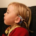 What is cochlear implant and how it works?