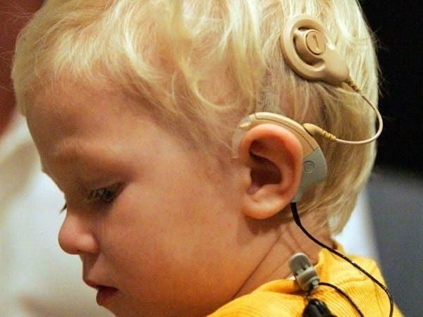 Cochlear implants