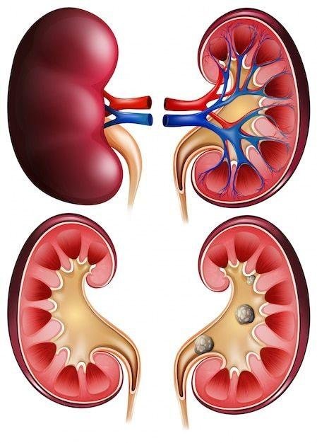 kidney pain and disability