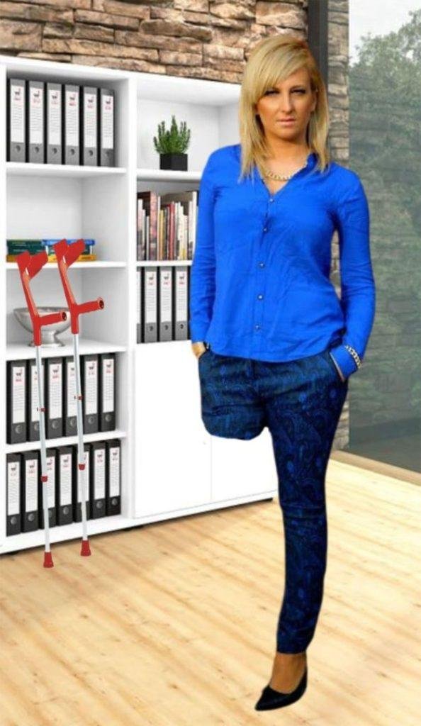 Some common symptoms experienced by amputees