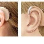 Effectiveness of cochlear implant vs. hearing aids
