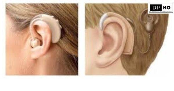 Effectiveness of cochlear implant vs. hearing aids